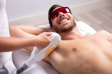 Laser varices