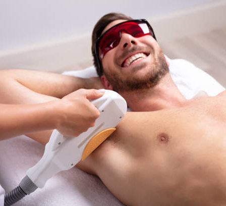 Laser varices