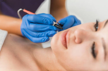 épilation laser à Villefranche