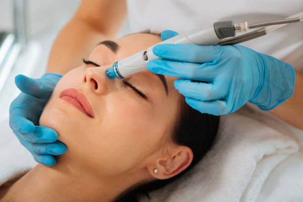 hydrafacial à Lyon 