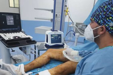Laser endoveineux