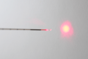 Laser varices