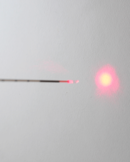 Laser varices