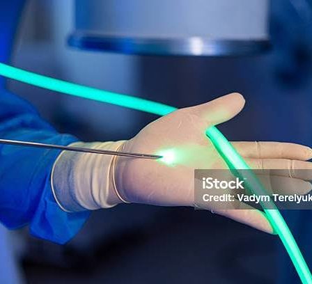 laser proctologie